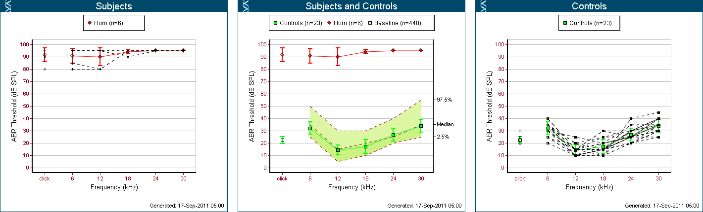 ABR Thresholds for MBNZ mutants and controls